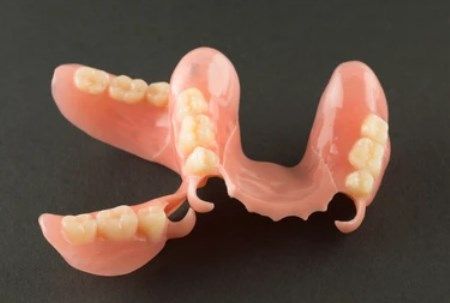 Что такое бюгельные протезы для зубов и какие лучше