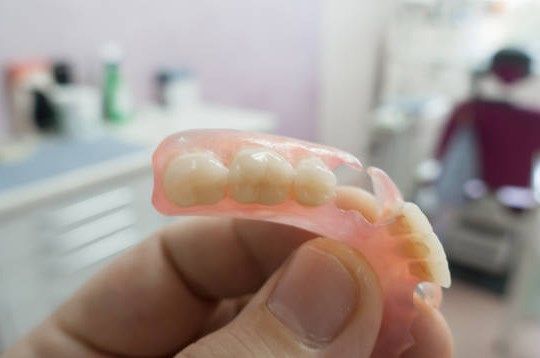 Покрывной протез зубов — цена под ключ