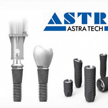 Зубные имплантаты Astra Tech