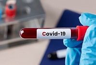 Пациенты жалуются на проблемы зубов после перенесенного COVID-19