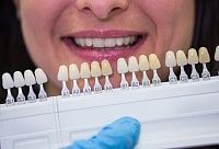 Можно ли поставить виниры на кривые зубы?